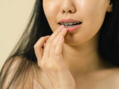 Aparatul dentar: tot ce trebuie să știi